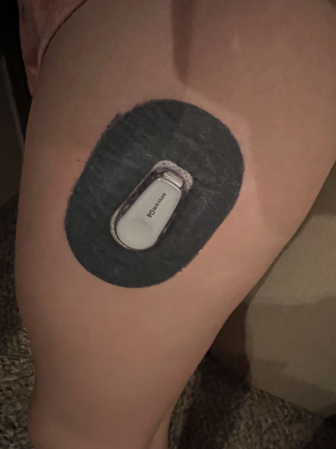 Customer photo review of Skin Grip MAX Dexcom G6 Patches