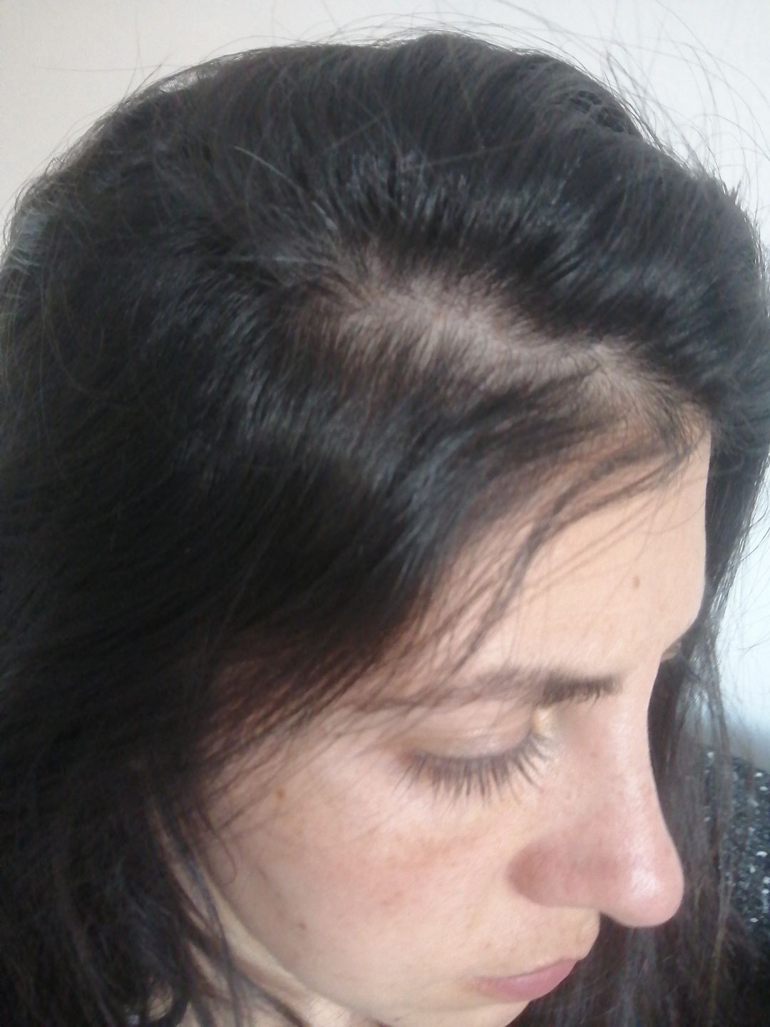 Customer photo review of SHAMPOO ANTICASPA GRASA FORMATO BARRA