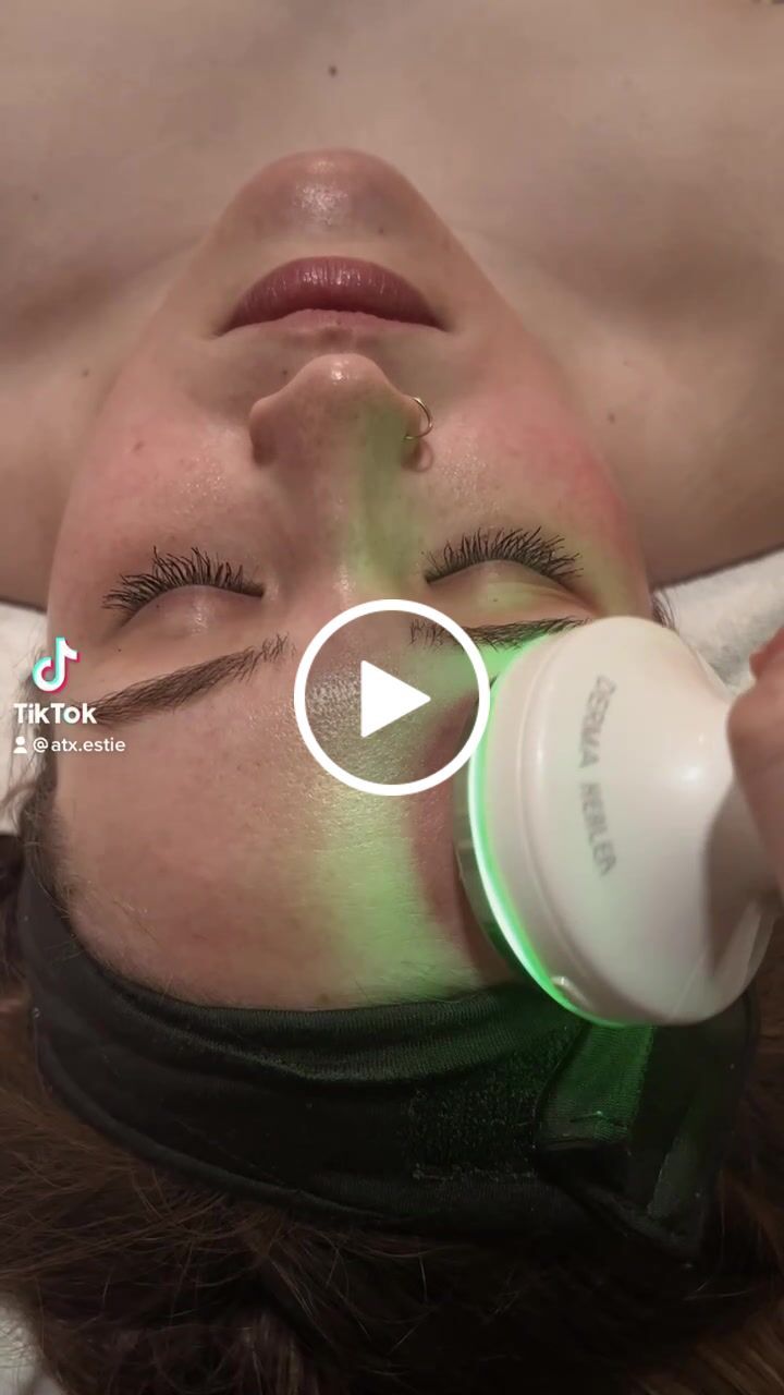 Customer video review of O'Melon 4 in 1 Derma Healer Device
