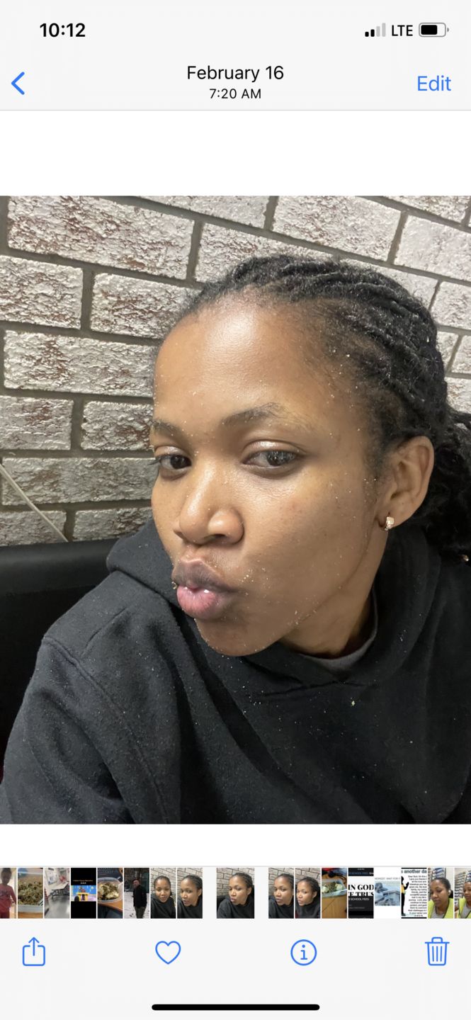 Customer photo review of Black spot remover
