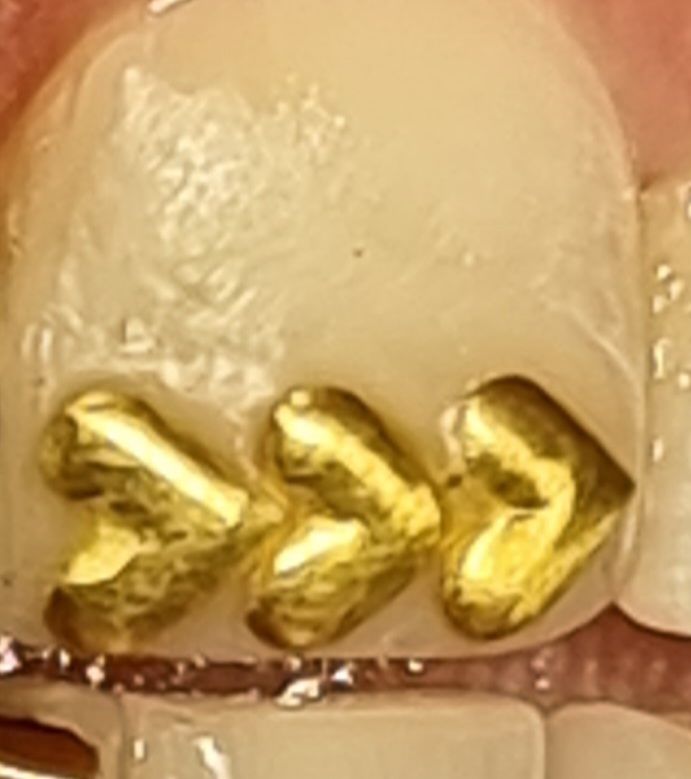Customer photo review of Large Heart 24-karat gold