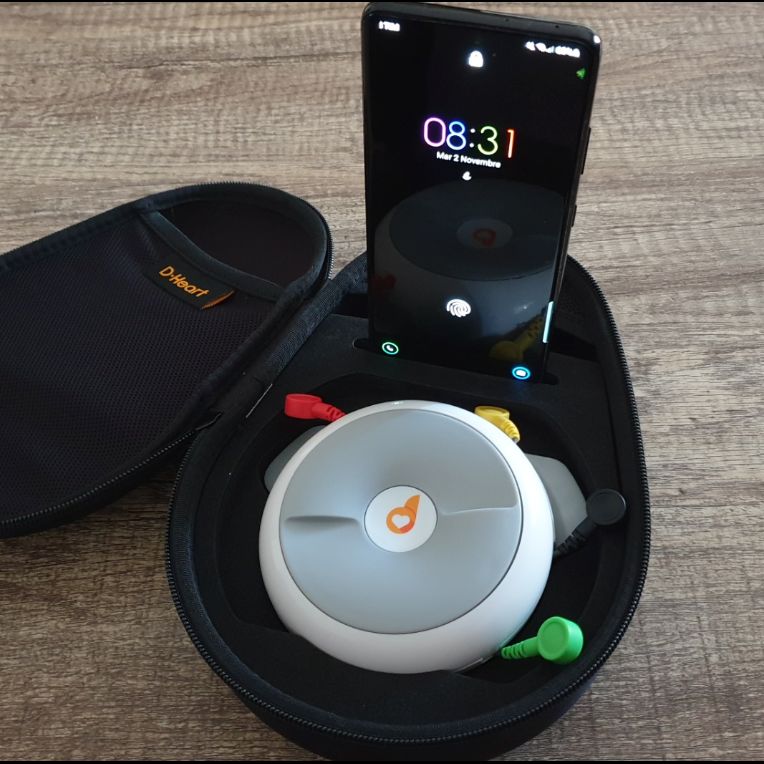Customer photo review of DISPOSITIVO ECG PROFESSIONALE