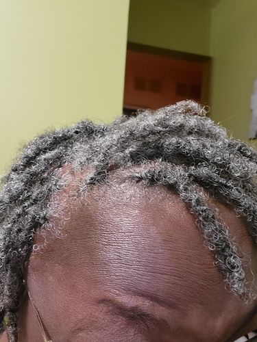 Customer photo review of NEW Item Alert! - Hair & Scalp Hydration Oil