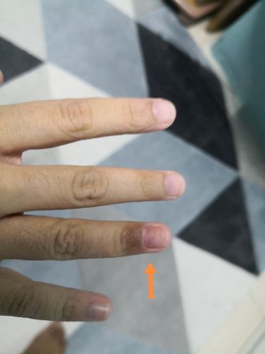 Customer photo review of Jolicare Cream
