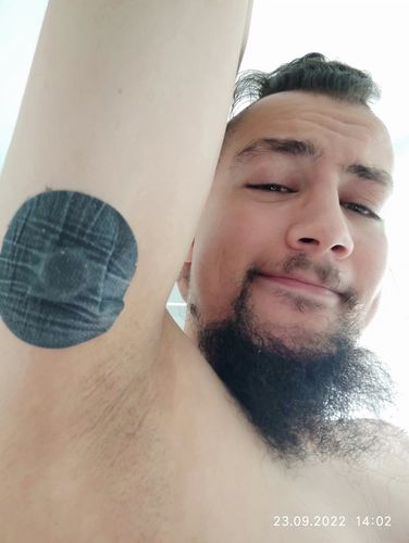 Customer photo review of Skin Grip MAX Freestyle Libre Patches