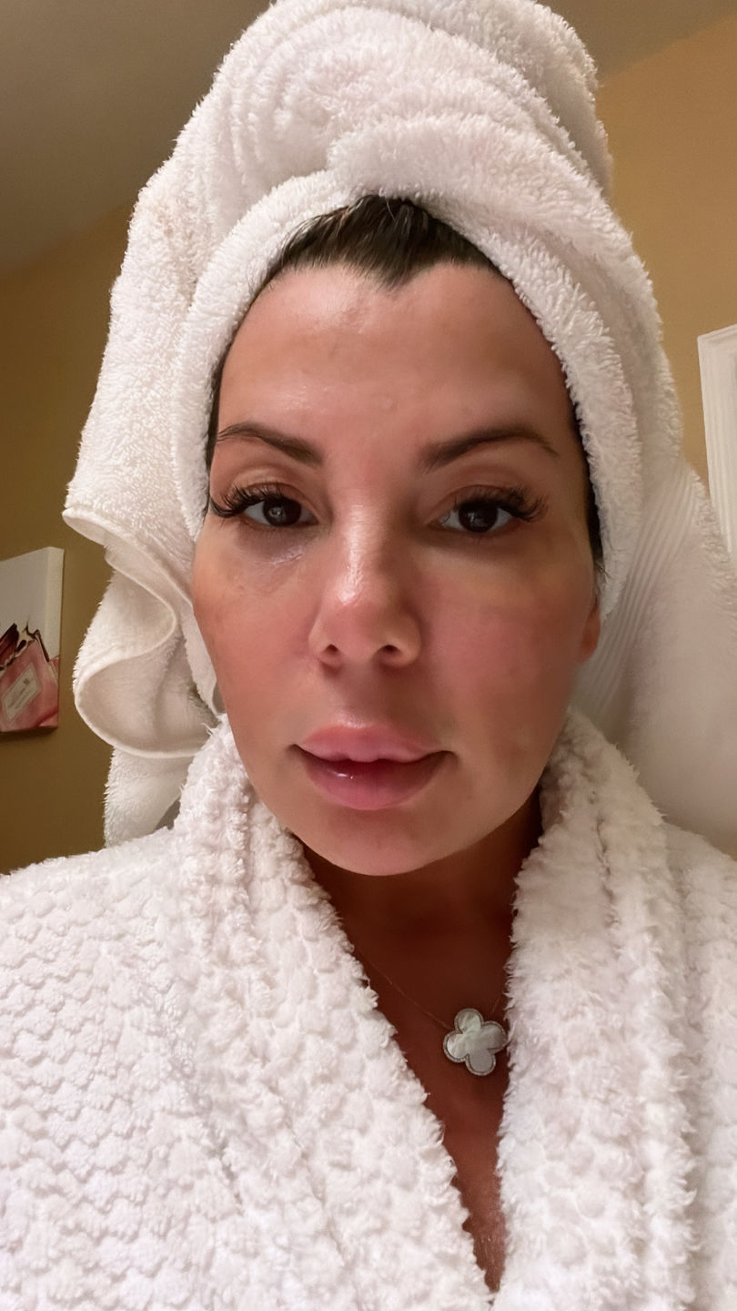Customer photo review of BEST SELLER! BACK IN STOCK 🤩 Premium Moisture-Boosting Serum with Co-Enzyme Q-10 & Powerful Growth Factor 1.7 oz. Covers all the ABCs of good skin care!