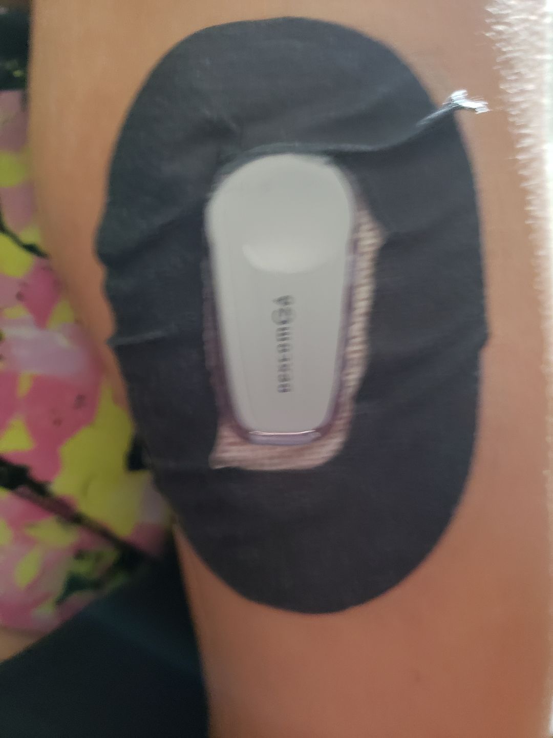 Customer photo review of Skin Grip MAX Dexcom G6 Patches