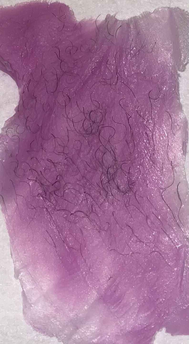 Customer photo review of At-Home Signature Series Hair Removal Wax