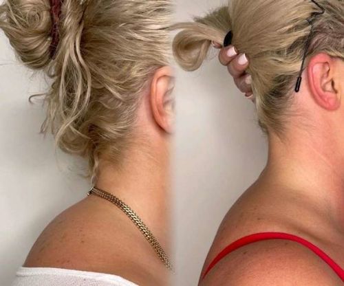 Customer photo review of TechTico EMS Lymphatic Relief Neck Massager