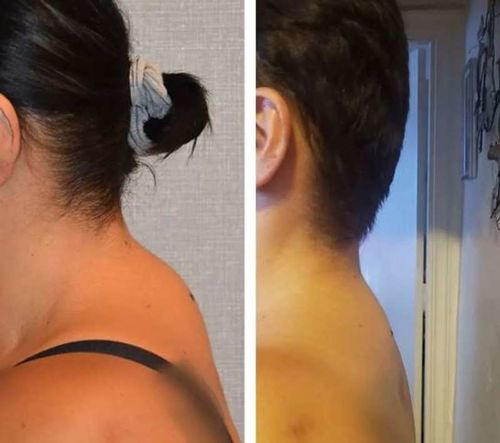 Customer photo review of TechTico EMS Lymphatic Relief Neck Massager