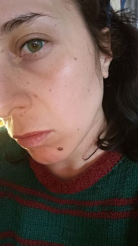 Customer photo review of Hyaluid