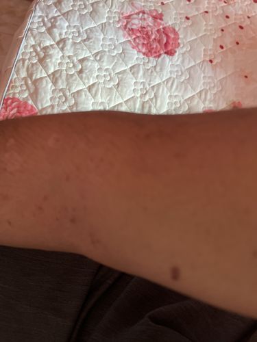 Customer photo review of Jolicare Cream