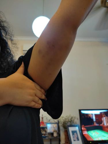 Customer photo review of [Pre-purchase] BUY 1 GET 1 Complimentary Service at MIMONE Spa TTDI