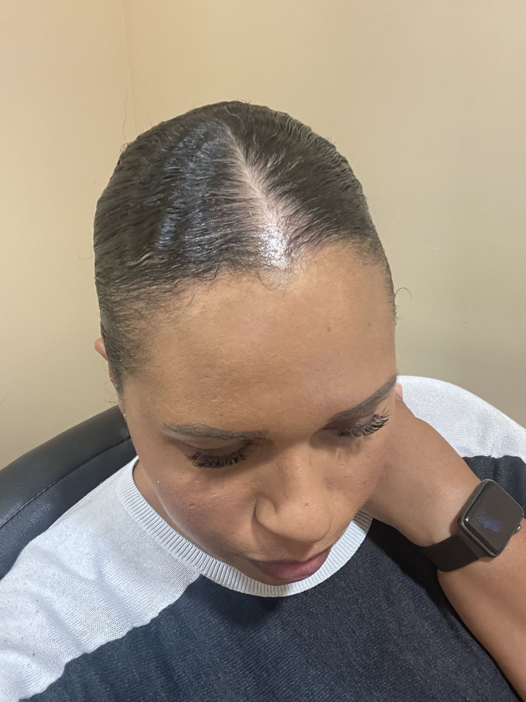 Customer photo review of Psoriasis Honey Scalp Nourishing Kit