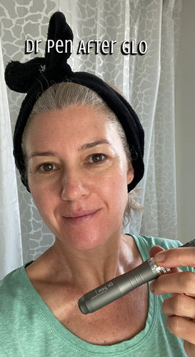 Customer photo review of Dr. Pen M8