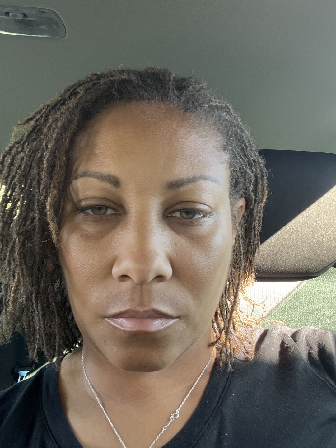 Customer photo review of A-Dream Brightening Eye Cream