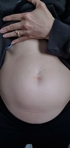 Customer photo review of Hydrate Belly Butter