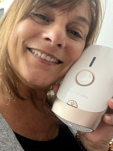 Customer photo review of Depiladora Láser Definitiva™