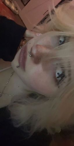 Customer photo review of Dead Contact Lenses(12 months of use)