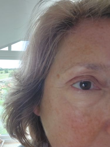 Customer photo review of Hydration Boost Moisturising Balm
