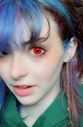 Customer photo review of Pure Pink Colored Contact Lenses(12 months of use)