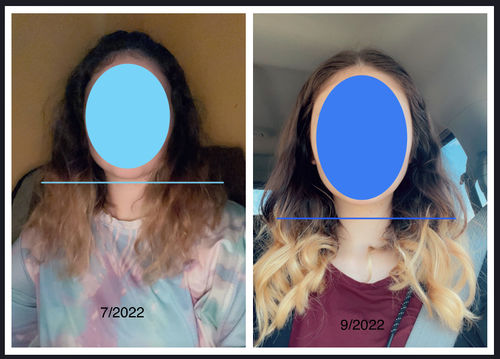 Customer photo review of Growth & Shine Hair Oil