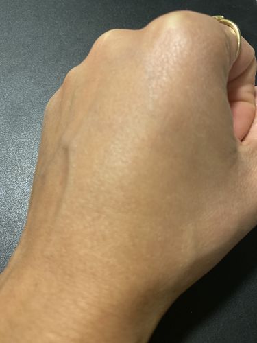 Customer photo review of huile de pépins de figue de barbarie bio 3 flacon 30ml + 1 flacon offert