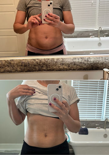 Customer photo review of Tummy Flattening and Skin Tightening Renew and Repair