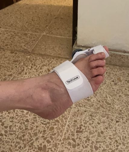 Customer photo review of The BigToeHero™