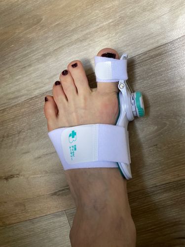 Customer photo review of The BigToeHero™
