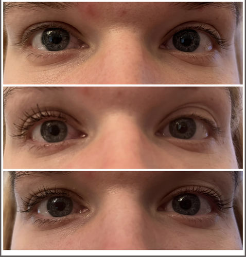 Customer photo review of BOOSTER Serum