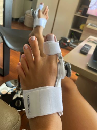 Customer photo review of The BigToeHero™