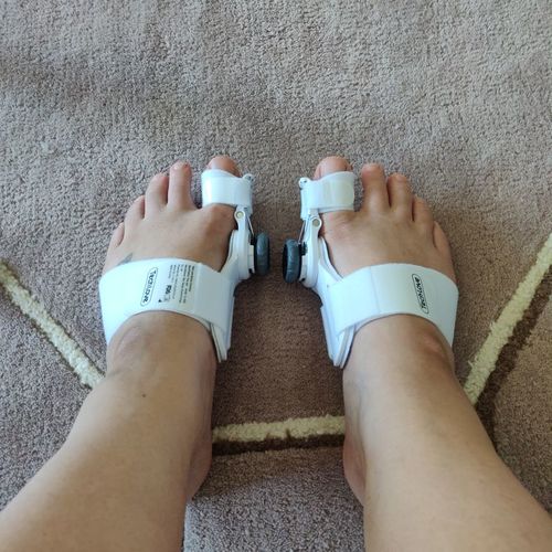 Customer photo review of The BigToeHero™