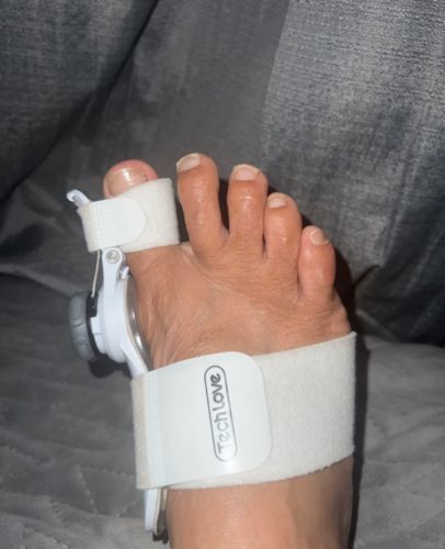 Customer photo review of The BigToeHero™