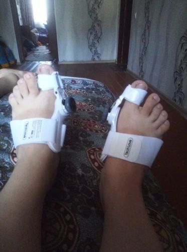 Customer photo review of The BigToeHero™