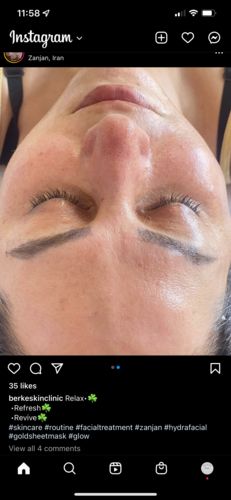 Customer photo review of Shine Serum - Light (NEW 30mL!)