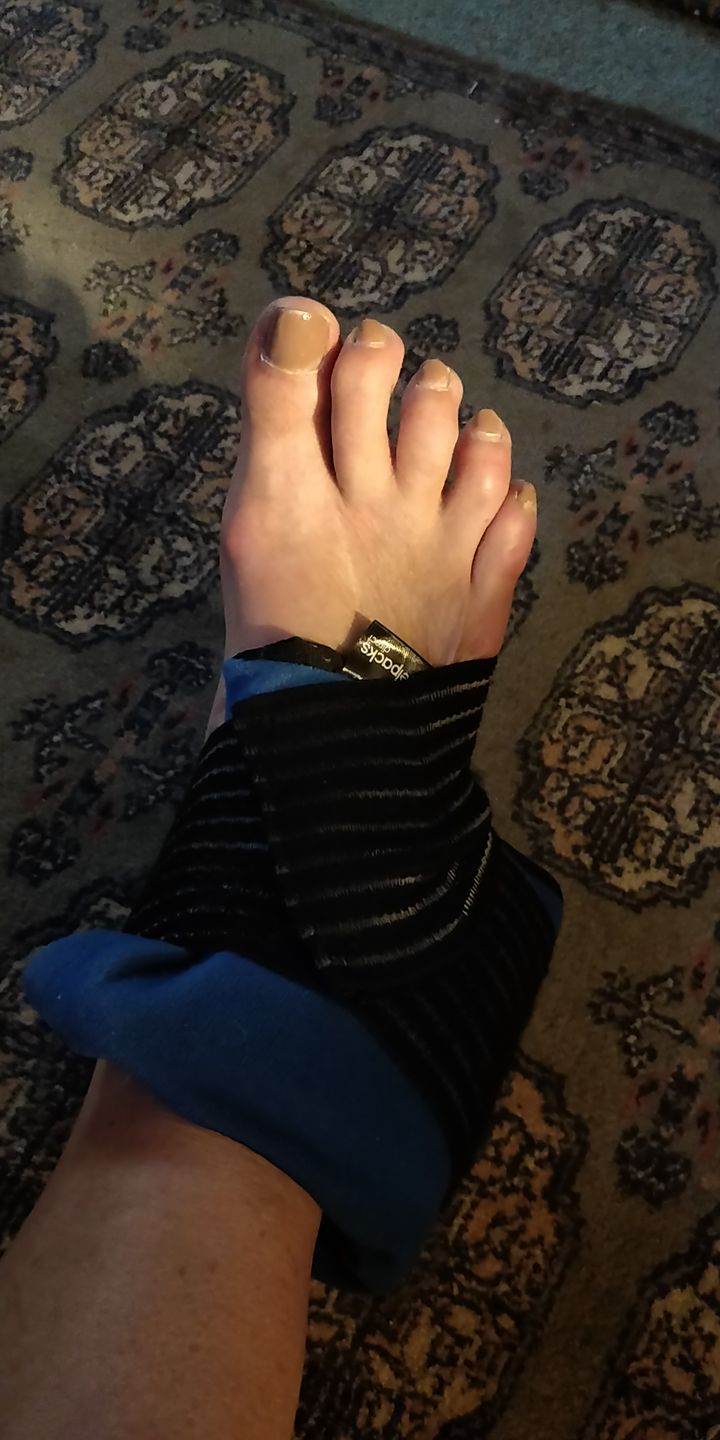 Customer photo review of Gelpacks Direct Reusable Sports Ice Pack for Ankle Injury with Hot Cold Compression Wrap