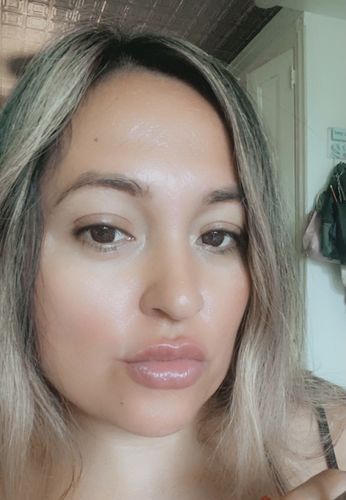 Customer photo review of LipFix: LipFlip