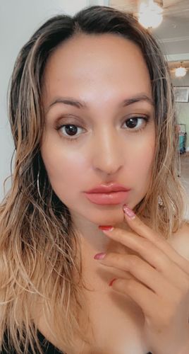 Customer photo review of LipFix: Filler