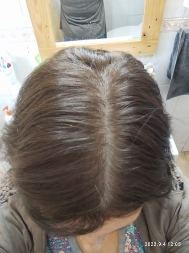 Customer photo review of Shampoo anticaída + Acondicionador Formato Barra