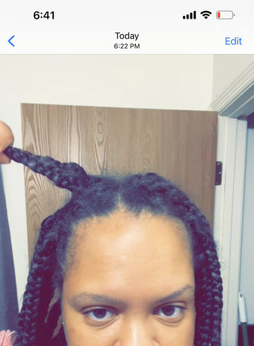 Customer photo review of Rice Water Scalp Mist (PreMade)