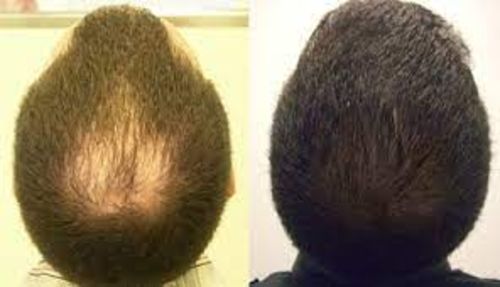 Customer photo review of Root Activator Conditioner