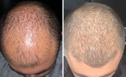 Customer photo review of Root Activator Spray