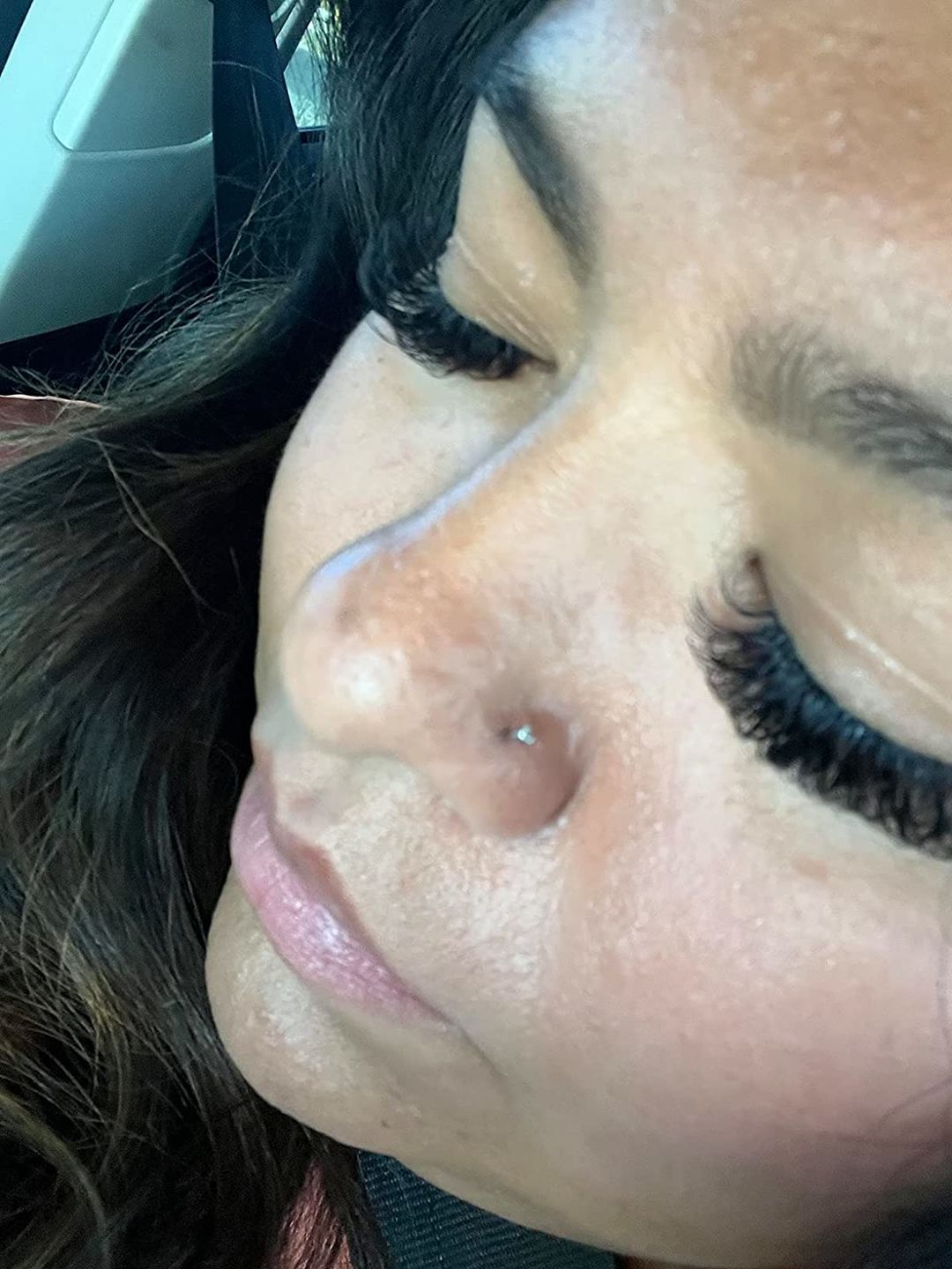 Customer photo review of Base Labs Piercing Bump Treatment & Keloid Bump Removal Drops 15ml