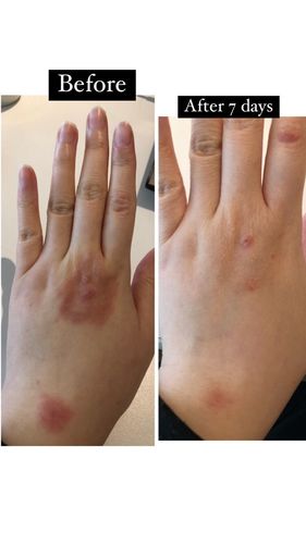 Customer photo review of Jolicare Cream