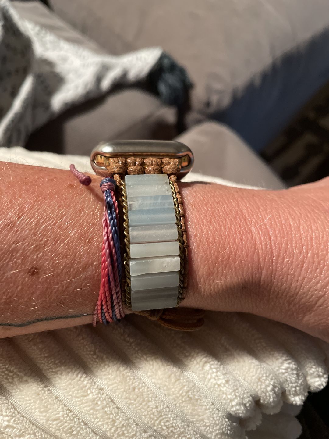 Customer photo review of Amazonite Protection Apple Watch Strap
