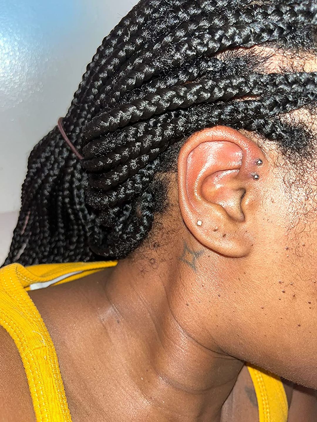 Customer photo review of Base Labs Piercing Aftercare Spray | Saline Solution For Healing | 4oz