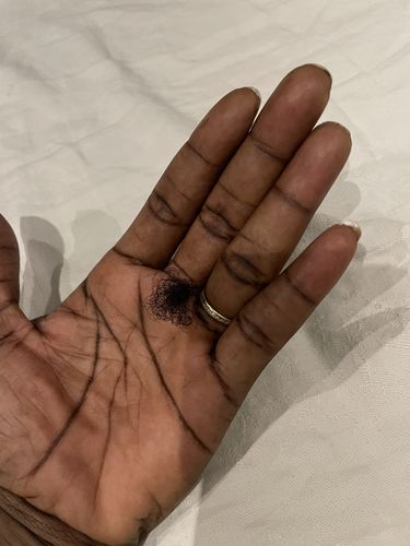 Customer photo review of Anti-Breakage Bundle