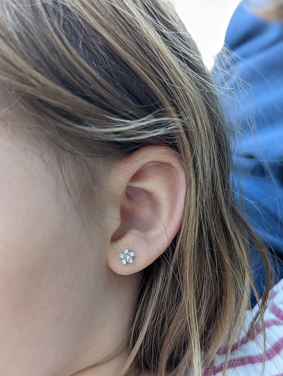 Customer photo review of Base Labs Piercing Aftercare Spray | Saline Solution For Healing | 4oz