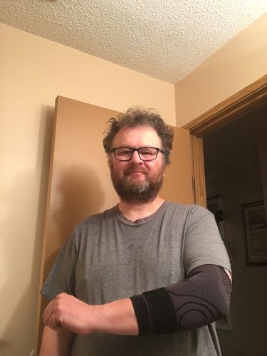 Customer photo review of 4D Compression Elbow Sleeve